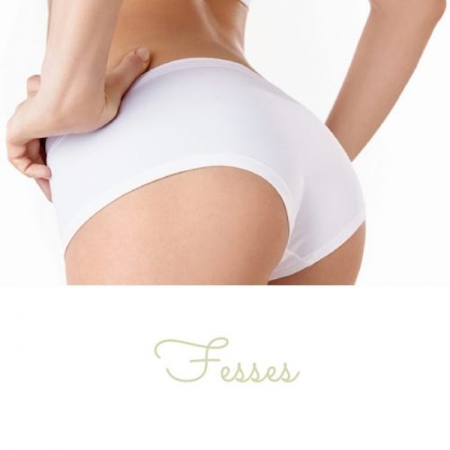 Fesses