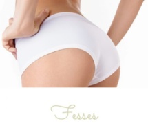 Fesses